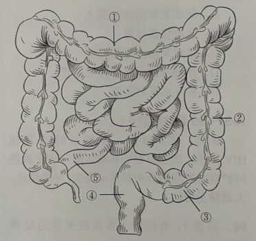 大肠癌好发部位图片